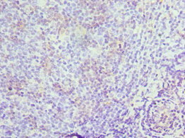 Immunohistochemistry of paraffin-embedded human tonsil tissue using MRE11 Antibody at dilution of 1:100Rabbit anti-Human MRE11 Polyclonal Antibody