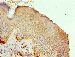 Immunohistochemistry of paraffin-embedded human skin tissue using MRE11 Antibody at dilution of 1:100Rabbit anti-Human MRE11 Polyclonal Antibody