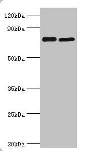 Western blot | All lanes: Double-strand break repair protein MRE11A antibody at 8μg/ml | Lane 1: 293T whole cell lysate | Lane 2: K562 whole cell lysate | Secondary | Goat polyclonal to rabbit IgG at 1/10000 dilution | Predicted band size: 81, 78, 82 kDa | Observed band size: 81 kDa