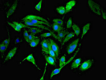 Immunofluorescent analysis of Hela cells using MRPL19 Antibody at dilution of 1:100 and Alexa Fluor 488-congugated AffiniPure Goat Anti-Rabbit IgG(H+L)Rabbit anti-Human MRPL19 Polyclonal Antibody
