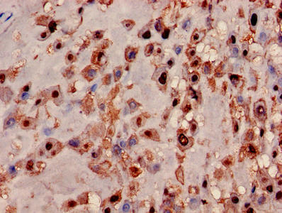 Immunohistochemistry of paraffin-embedded human placenta tissue using MRPL19 Antibody at dilution of 1:100Rabbit anti-Human MRPL19 Polyclonal Antibody