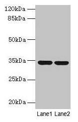 Western blot  | All lanes: MRPL19 antibody at 2µg/ml  | Lane 1: MCF-7 whole cell lysate  | Lane 2: Mouse liver tissue  | Secondary  | Goat polyclonal to rabbit IgG at 1/10000 dilution  | Predicted band size: 34 kDa  | Observed band size: 34 kDa