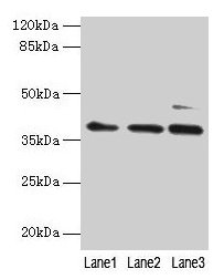 Western blot  | All lanes: MRPL3 antibody at 6µg/ml  | Lane 1: Hela whole cell lysate  | Lane 2: HepG2 whole cell lysate  | Lane 3: A549 whole cell lysate  | Secondary  | Goat polyclonal to rabbit IgG at 1/10000 dilution  | Predicted band size: 39 kDa  | Observed band size: 39 kDa