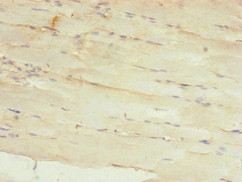 Immunohistochemistry of paraffin-embedded human skeletal muscle tissue using MRPS22 Antibody at dilution of 1:100Rabbit anti-Human MRPS22 Polyclonal Antibody