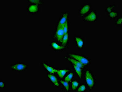 Immunofluorescent analysis of Hela cells using CKB Antibody at dilution of 1:100 and Alexa Fluor 488-congugated AffiniPure Goat Anti-Rabbit IgG(H+L)Rabbit anti-Human CKB Polyclonal Antibody