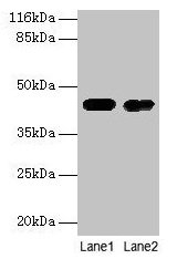 Western blot  | All lanes: CKB antibody at 2µg/ml  | Lane 1: Mouse brain tissue  | Lane 2: 293T whole cell lysate  | Secondary  | Goat polyclonal to rabbit IgG at 1/10000 dilution  | Predicted band size: 43 kDa  | Observed band size: 43 kDaRabbit anti-Human CKB Polyclonal Antibody