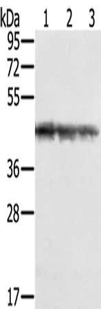 Gel: 8%SDS-PAGE, Lysate: 40 μg, Lane 1-3: Jurkat cells, K562 cells, hepg2 cells, Primary antibody: SMARCB1 Antibody(SMARCB1 Antibody) at dilution 1/450, Secondary antibody: Goat anti rabbit IgG at 1/8000 dilution, Exposure time: 10 secondsRabbit anti-Human SMARCB1 Polyclonal Antibody