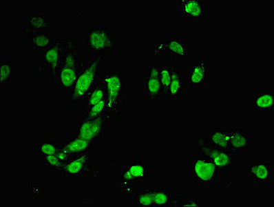 Immunofluorescent analysis of Hela cells using MSH6 Antibody at dilution of 1:100 and Alexa Fluor 488-congugated AffiniPure Goat Anti-Rabbit IgG(H+L)Rabbit anti-Human MSH6 Polyclonal Antibody