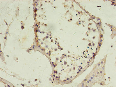 Immunohistochemistry of paraffin-embedded human testis tissue using the antibody at dilution of 1:100Rabbit anti-Human MSH6 Polyclonal Antibody