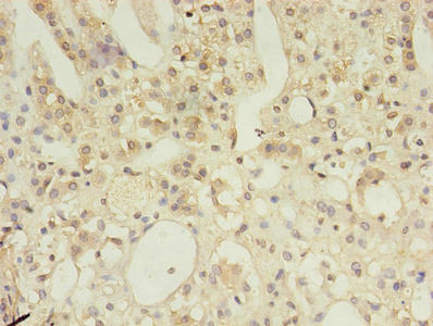 Immunohistochemistry of paraffin-embedded human adrenal gland tissue using MSH6 Antibody at dilution of 1:100Rabbit anti-Human MSH6 Polyclonal Antibody