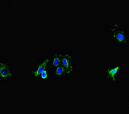 Immunofluorescent analysis of Hela cells using MT-CO1 Antibody at dilution of 1:100 and Alexa Fluor 488-congugated AffiniPure Goat Anti-Rabbit IgG(H+L)Rabbit anti-Human MT-CO1 Polyclonal Antibody