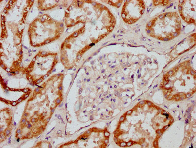 IHC image of MT-CO2 Antibody diluted at 1:400 and staining in paraffin-embedded human kidney tissue performed on a Leica BondTM system. After dewaxing and hydration, antigen retrieval was mediated by high pressure in a citrate buffer (pH 6.0). Section was blocked with 10% normal goat serum 30min at RT. Then primary antibody (1% BSA) was incubated at 4°C overnight. The primary is detected by a biotinylated secondary antibody and visualized using an HRP conjugated SP system.Rabbit anti-Human MT-CO2 Polyclonal Antibody