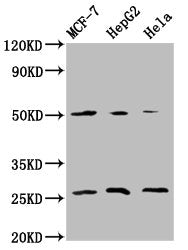 Western Blot  | Positive WB detected in: MCF-7 whole cell lysate, HepG2 whole cell lysate, Hela whole cell lysate  | All lanes: MT-CO2 antibody at 5.9µg/ml  | Secondary  | Goat polyclonal to rabbit IgG at 1/50000 dilution  | Predicted band size: 26 kDa  | Observed band size: 26 kDaRabbit anti-Human MT-CO2 Polyclonal Antibody
