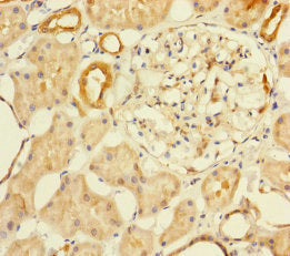 Immunohistochemistry of paraffin-embedded human kidney tissue using MTHFD2 Antibody at dilution of 1:100Rabbit anti-Human MTHFD2 Polyclonal Antibody