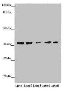 Western blot  | All lanes: MTHFD2 antibody at 4.99µg/ml  | Lane 1: 293 whole cell lysate  | Lane 2: A431 whole cell lysate  | Lane 3: HepG2 whole cell lysate  | Lane 4: Hela whole cell lysate  | Lane 5: K562 whole cell lysate  | Secondary  | Goat polyclonal to rabbit IgG at 1/10000 dilution  | Predicted band size: 38, 27 kDa  | Observed band size: 38 kDaRabbit anti-Human MTHFD2 Polyclonal Antibody