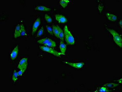 Immunofluorescent analysis of Hela cells using MTHFR Antibody at dilution of 1:100 and Alexa Fluor 488-congugated AffiniPure Goat Anti-Rabbit IgG(H+L)Rabbit anti-Human MTHFR Polyclonal Antibody