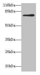 Western blot  | All lanes: MTHFR antibody at 2µg/ml + 293T whole cell lysate  | Secondary  | Goat polyclonal to rabbit IgG at 1/10000 dilution  | Predicted band size: 75, 79 kDa  | Observed band size: 75 kDaRabbit anti-Human MTHFR Polyclonal Antibody