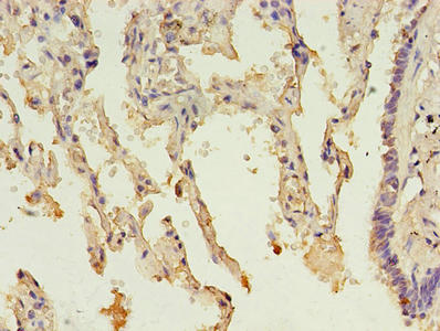 Immunohistochemistry of paraffin-embedded human lung tissue using MTHFS Antibody at dilution of 1:100Rabbit anti-Human MTHFS Polyclonal Antibody