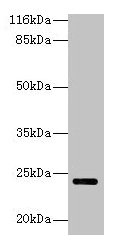 Western blot  | All lanes: MTHFS antibody at 2µg/ml + Hela whole cell lysate  | Secondary  | Goat polyclonal to rabbit IgG at 1/10000 dilution  | Predicted band size: 24, 21 kDa  | Observed band size: 24 kDaRabbit anti-Human MTHFS Polyclonal Antibody