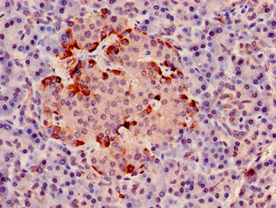 Immunohistochemistry of paraffin-embedded human pancreatic tissue using CYC1 Antibody at dilution of 1:100Rabbit anti-Human CYC1 Polyclonal Antibody