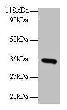 Western blot  | All lanes: CYC1 antibody at 2µg/ml + EC109 whole cell lysate  | Secondary  | Goat polyclonal to rabbit IgG at 1/15000 dilution  | Predicted band size: 36 kDa  | Observed band size: 36 kDaRabbit anti-Human CYC1 Polyclonal Antibody
