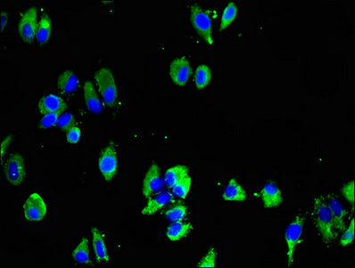 Immunofluorescent analysis of HepG2 cells using MTNR1B Antibody at dilution of 1:100 and Alexa Fluor 488-congugated AffiniPure Goat Anti-Rabbit IgG(H+L)Rabbit anti-Human MTNR1B Polyclonal Antibody