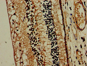 Immunohistochemistry of paraffin-embedded human eye tissue using the antibody at dilution of 1:100Rabbit anti-Human MTNR1B Polyclonal Antibody