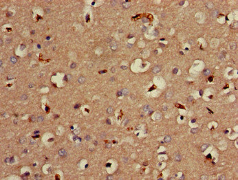 Immunohistochemistry of paraffin-embedded human brain tissue using MTNR1B Antibody at dilution of 1:100Rabbit anti-Human MTNR1B Polyclonal Antibody