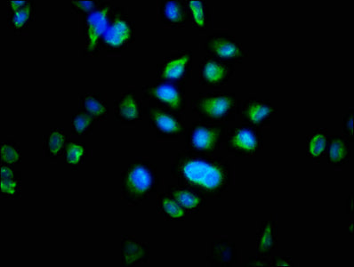 Immunofluorescence staining of Hela cells with the antibody at 1:100, counter-stained with DAPI. The cells were fixed in 4% formaldehyde, permeabilized using 0.2% Triton X-100 and blocked in 10% normal Goat Serum. The cells were then incubated with the antibody overnight at 4°C. The secondary antibody was Alexa Fluor 488-congugated AffiniPure Goat Anti-Rabbit IgG(H+L).Rabbit anti-Human MTRF1 Polyclonal Antibody