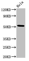 Western Blot | Positive WB detected in: Hela whole cell lysate | All lanes: MTRF1 antibody at 3μg/ml | Secondary | Goat polyclonal to rabbit IgG at 1/50000 dilution | Predicted band size: 53, 55 kDa | Observed band size: 53 kDaRabbit anti-Human MTRF1 Polyclonal Antibody