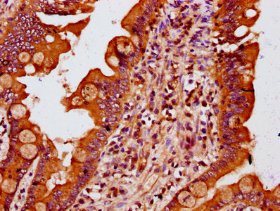 IHC image of MTSS1 Antibody diluted at 1:400 and staining in paraffin-embedded human small intestine tissue performed on a Leica BondTM system. After dewaxing and hydration, antigen retrieval was mediated by high pressure in a citrate buffer (pH 6.0). Section was blocked with 10% normal goat serum 30min at RT. Then primary antibody (1% BSA) was incubated at 4°C overnight. The primary is detected by a biotinylated secondary antibody and visualized using an HRP conjugated SP system.Rabbit anti-Human MTSS1 Polyclonal Antibody
