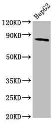 Western Blot | Positive WB detected in: HepG2 whole cell lysate | All lanes: MTSS1 antibody at 3.84μg/ml | Secondary | Goat polyclonal to rabbit IgG at 1/50000 dilution | Predicted band size: 83, 51, 80 kDa | Observed band size: 83 kDaRabbit anti-Human MTSS1 Polyclonal Antibody