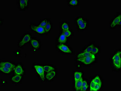 Immunofluorescent analysis of HepG2 cells using MTTP Antibody at dilution of 1:100 and Alexa Fluor 488-congugated AffiniPure Goat Anti-Rabbit IgG(H+L)Rabbit anti-Human MTTP Polyclonal Antibody