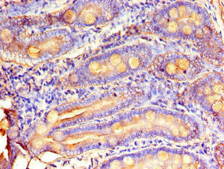 Immunohistochemistry of paraffin-embedded human small intestine tissue using the antibody at dilution of 1:100Rabbit anti-Human MTTP Polyclonal Antibody
