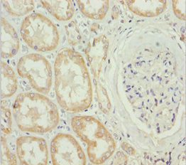 Immunohistochemistry of paraffin-embedded human kidney tissue using MTX2 Antibody at dilution of 1:100Rabbit anti-Human MTX2 Polyclonal Antibody