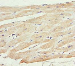 Immunohistochemistry of paraffin-embedded human heart tissue using MTX2 Antibody at dilution of 1:100Rabbit anti-Human MTX2 Polyclonal Antibody