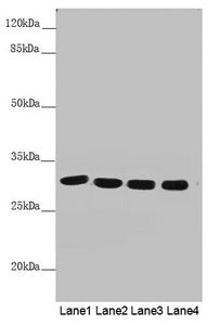 Western blot | All lanes: MTX2 antibody at 4.53 μg/ml | Lane 1: Mouse heart tissue | Lane 2: Mouse kidney tissue | Lane 3: Jurkat whole cell lysate | Lane 4: Mouse liver tissue | Secondary | Goat polyclonal to rabbit IgG at 1/10000 dilution | Predicted band size: 30, 29 kDa | Observed band size: 30 kDaRabbit anti-Human MTX2 Polyclonal Antibody