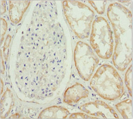 Immunohistochemistry of paraffin-embedded human kidney tissue using MTX2 Antibody at dilution of 1:100Rabbit anti-Human MTX2 Polyclonal Antibody