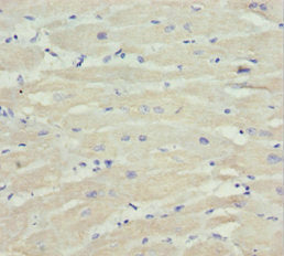 Immunohistochemistry of paraffin-embedded human heart tissue using MTX2 Antibody at dilution of 1:100Rabbit anti-Human MTX2 Polyclonal Antibody