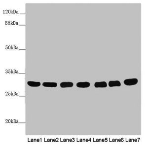 Western blot | All lanes: MTX2 antibody at 3.79 μg/ml | Lane 1: Mouse heart tissue | Lane 2: Mouse kidney tissue | Lane 3: Mouse liver tissue | Lane 4: Jurkat whole cell lysate | Lane 5: MCF-7 whole cell lysate | Lane 6: HepG2 whole cell lysate | Lane 7: 293T whole cell lysate | Secondary | Goat polyclonal to rabbit IgG at 1/10000 dilution | Predicted band size: 30, 29 kDa | Observed band size: 30 kDaRabbit anti-Human MTX2 Polyclonal Antibody