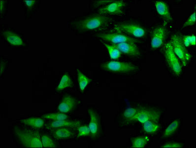 Immunofluorescence staining of Hela cells with MVD Antibody at 1:100, counter-stained with DAPI. The cells were fixed in 4% formaldehyde, permeabilized using 0.2% Triton X-100 and blocked in 10% normal Goat Serum. The cells were then incubated with the antibody overnight at 4°C. The secondary antibody was Alexa Fluor 488-congugated AffiniPure Goat Anti-Rabbit IgG(H+L).