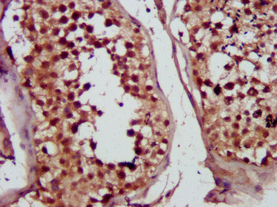 IHC image of MVD Antibody diluted at 1:300 and staining in paraffin-embedded human testis tissue performed on a Leica BondTM system. After dewaxing and hydration, antigen retrieval was mediated by high pressure in a citrate buffer (pH 6.0). Section was blocked with 10% normal goat serum 30min at RT. Then primary antibody (1% BSA) was incubated at 4°C overnight. The primary is detected by a biotinylated secondary antibody and visualized using an HRP conjugated SP system.