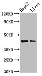 Western Blot  | Positive WB detected in: HepG2 whole cell lysate, Rat liver tissue  | All lanes: MVD antibody at 7.4µg/ml  | Secondary  | Goat polyclonal to rabbit IgG at 1/50000 dilution  | Predicted band size: 44 kDa  | Observed band size: 44 kDa