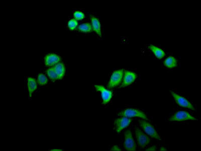 Immunofluorescent analysis of Hela cells using MX1 Antibody at dilution of 1:100 and Alexa Fluor 488-congugated AffiniPure Goat Anti-Rabbit IgG(H+L)Rabbit anti-Human MX1 Polyclonal Antibody