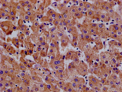 Immunohistochemistry of paraffin-embedded human liver  tissue using MX1 Antibody at dilution of 1:100Rabbit anti-Human MX1 Polyclonal Antibody