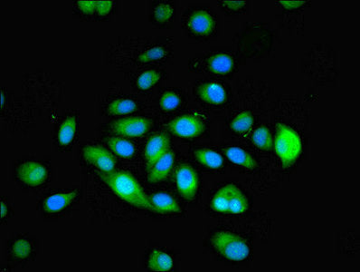 Immunofluorescent analysis of A549 cells using MYADM Antibody at dilution of 1:100 and Alexa Fluor 488-congugated AffiniPure Goat Anti-Rabbit IgG(H+L)Rabbit anti-Human MYADM Polyclonal Antibody
