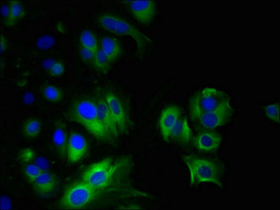 Immunofluorescent analysis of MCF-7 cells using MYADM Antibody at dilution of 1:100 and Alexa Fluor 488-congugated AffiniPure Goat Anti-Rabbit IgG(H+L)Rabbit anti-Human MYADM Polyclonal Antibody