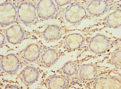 Immunohistochemistry of paraffin-embedded human colon tissue using the antibody at dilution of 1:100Rabbit anti-Human MYADM Polyclonal Antibody