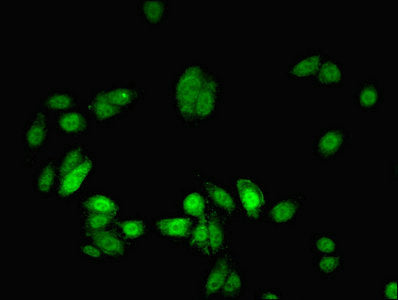 Immunofluorescent analysis of HepG2 cells using MYEF2 Antibody at dilution of 1:100 and Alexa Fluor 488-congugated AffiniPure Goat Anti-Rabbit IgG(H+L)Rabbit anti-Human MYEF2 Polyclonal Antibody