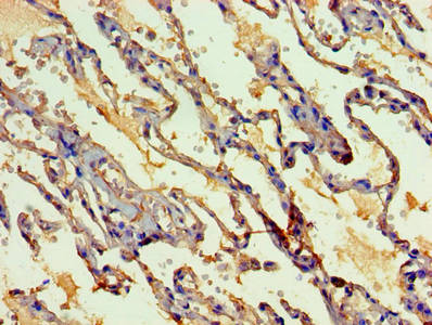 Immunohistochemistry of paraffin-embedded human lung tissue using MYEF2 Antibody at dilution of 1:100Rabbit anti-Human MYEF2 Polyclonal Antibody